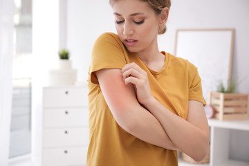 Woman scratching arm indoors, space for text. Allergy symptoms - obrazy, fototapety, plakaty