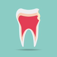 tooth wear brace on the blue background