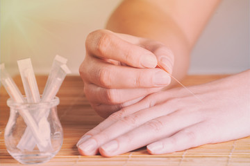 Hand applying acupuncture needle