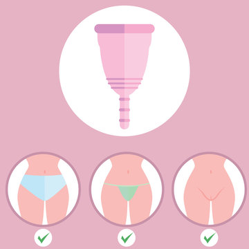 Infographics of menstrual cup. Menstrual cup - feminine hygiene product, device for collecting blood during menstruation and period © Graphicroyalty