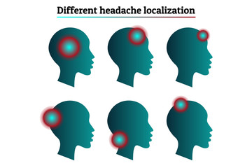 Medical infographic template set - types and localizations of headache, migraine. Human head silhouette with pain localization sign mark. White background. For poster, presentation, brochure.