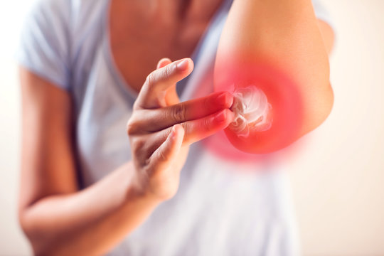 Woman applies cream on dry elbow.People, healthcare and medicine concept
