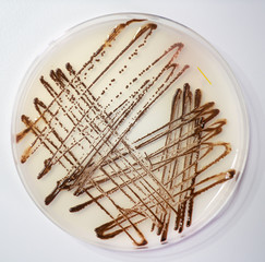 Sowing human feces in a petri dish