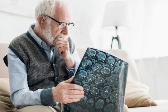 Concentrated senior man in glasses looking at x-ray picture