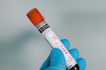 Doctor's hand with medical glove holding a blood probe with handwritings in front of a lab