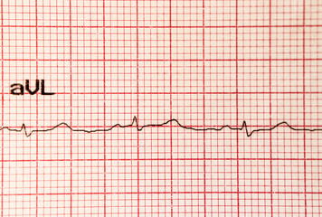 Cardiogram