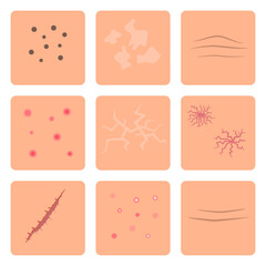 Skin problems concept.