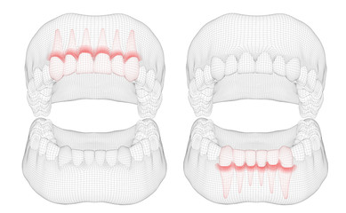 human jaw. 3d vector layout. medicine and health. pain teeth.