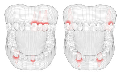 human jaw. 3d vector layout. medicine and health. pain teeth.
