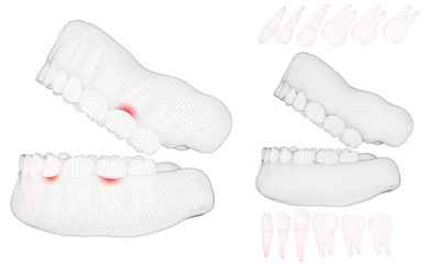 human jaw. 3d vector layout. medicine and health. pain teeth.
