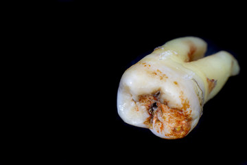 bad tooth on black background