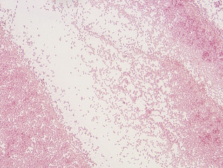 Microbiological microscope photograph