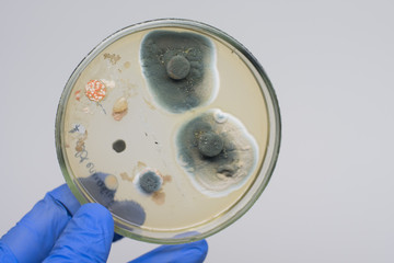 Antibiotics act on bacteria in a petri dish. Mold test in a man’s house. Close-up scientist holding a petri dish with colonies of bacteria in front of him. 