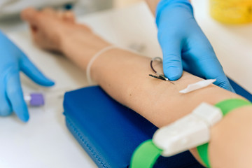Biochemical analysis of blood in women. HIV test for a young girl. A blood sample from a vein for...