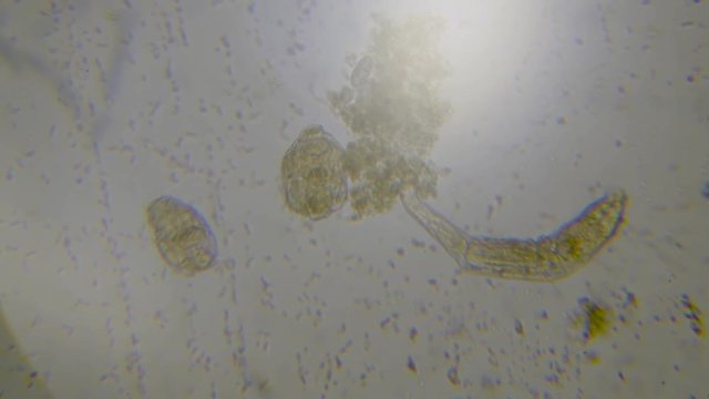 Microscopic Rotifier footage, closeup macro, moving and eating