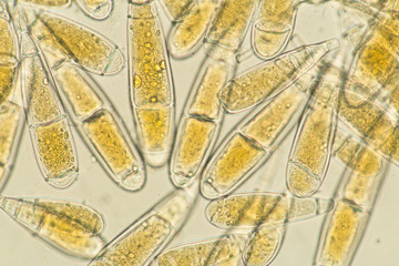 microscopic view of spores of Bactridium flavum fungus