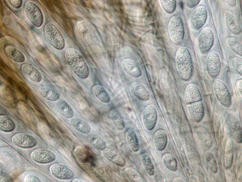 microscopic view of Tympanidaceae cup fungus showing spores, asci and paraphyses