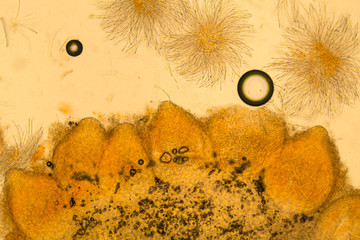 microscopic view of perithecia of Hypomyces armeniacus fungus