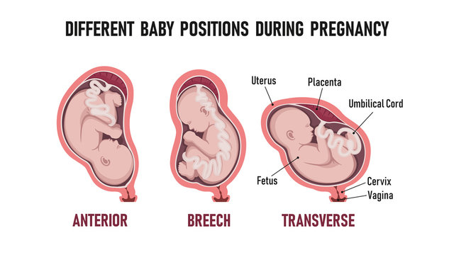 Different baby positions during pregnancy