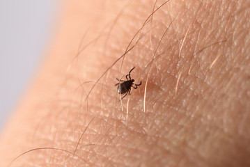 tick climbs on the skin