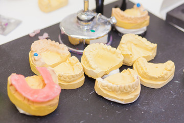 many dental prosthesis molds on technician's desk