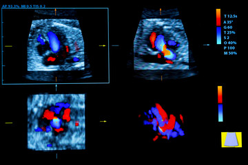 Colourful image of modern ultrasound monitor