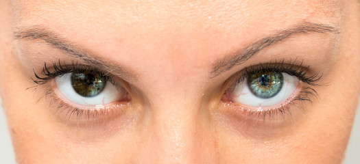 Heterochromia iridium in female beautiful eyes