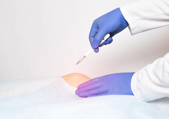 Doctor surgeon with a scalpel in his hand makes an incision in the knee joint. Concept of joint...