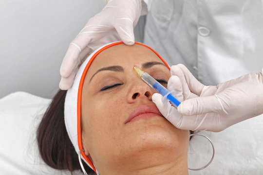 Glabella Injection
