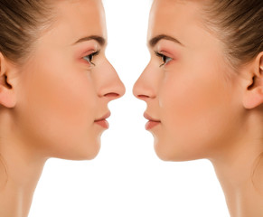 Comparison portrait of same woman before and after nose surgery on white background