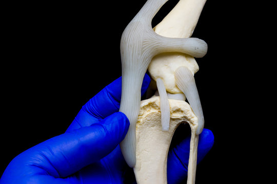 dog knee joint mold in the hand of the veterinarian and black background