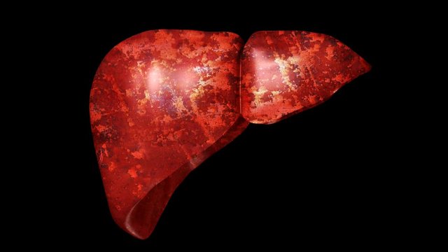 Stage of a Liver to the patient because of diseases like greasy, liver fibrosis, cirrhosis, hepatitis and cancer