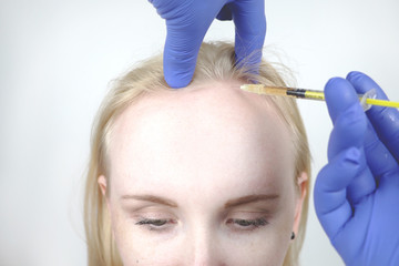 Hair mesotherapy or hair transplant: a beautician doctor makes injections in the head of a woman...