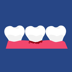 Trio of molars.