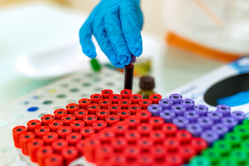 Laboratory worker puts tube with blood on a special rack with many colorful vials. A lot of test tubes with blood samples with colored lids on the rack and a hand of a lab technician adds one.