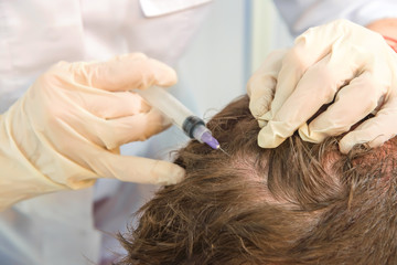 Mesotherapy of the scalp. Male pattern baldness. Bald on the man's head. The doctor makes a shot in...