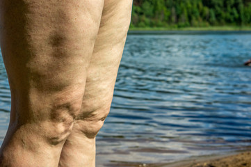 Knees Mature women closeup