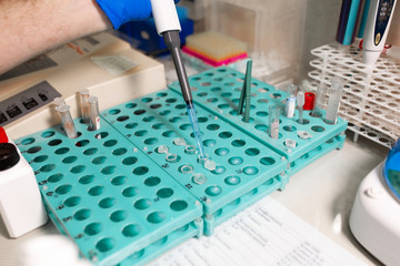 laboratory assistant analyzing a blood sample using micropipette