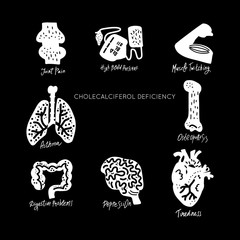 VitaminD Deficiency vector
