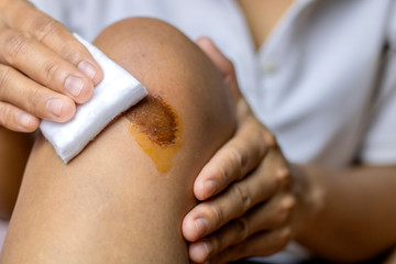 A man with a wound in his knees and he wound himself