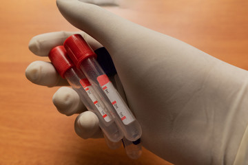 Pro-coagulation Plain Clot Activator blood collection tubes,with red plastic stopper held by hand In Laboratory