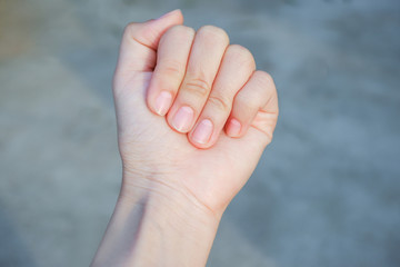 Lunula on fingernails (Half Moon) can hint at digestive problems or the effects of high blood...