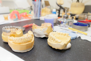 many dental prosthesis molds on technician's desk