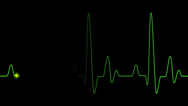 Green heart pulse graphic line on black, healthcare medical animation of EKG heart beat with heart cardiogram, cardiology concept pulse rate diagram animation.