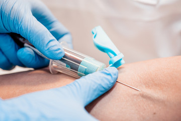 A blood test is a necessary diagnostic tool - it allows you to quickly or as accurately as possible...