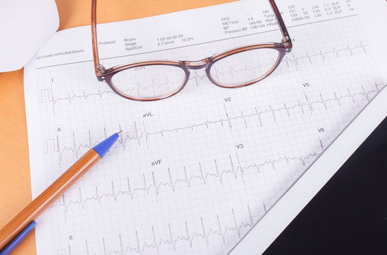ECG diagram,EKG diagram,medical result