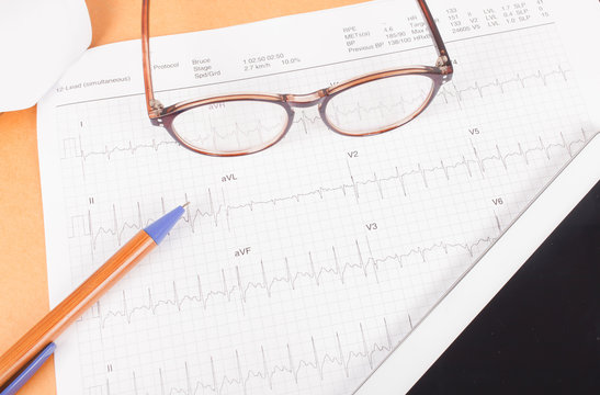 ECG diagram,EKG diagram,medical result
