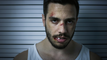 Close-up Portrait Shot of an Arrested Beaten Man in a Police Station Poses for Front View Mugshot....