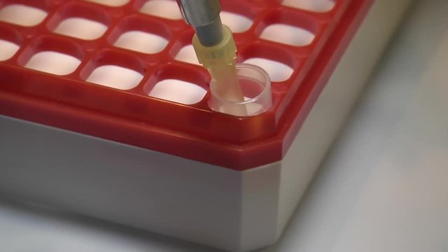 Put fluid sample in cryovial in storage box