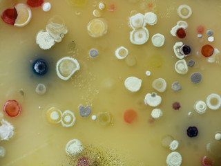 The growth of Actinobacteria cololonies on Cyganow and Žukov's agar plates, with different colony texture and colors.